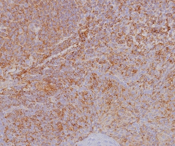 HLA-ABC Antibody (MHC I)