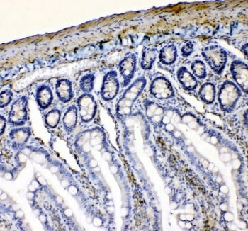 IHC staining of FFPE rat intestine tissue with VASP antibody. HIER: boil tissue sections in pH8 EDTA