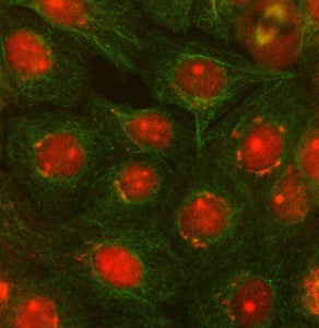 Immunofluorescent staining of OTUD5 using anti-OTUD5 antibody (red) and anti-Beta Tubulin antibody (