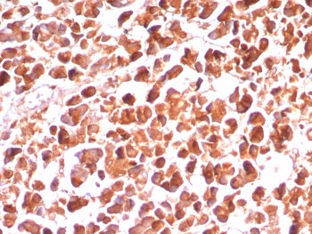 IHC staining of FFPE human pancreas tissue with CPA1 antibody (clone CPA1/8289R). HIER: boil tissue