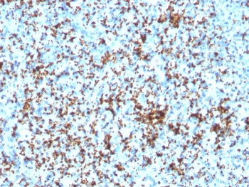 Integrin beta 3 Antibody / ITGB3 / CD61