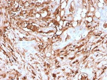 IHC staining of FFPE human pancreas with recombinant FTL antibody (clone rFTL/1388). HIER: boil tiss