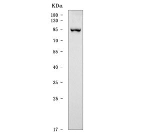Western blot testing of human HEL cell lysate with SATB2 antibody. Predicted molecular weight ~83 kD