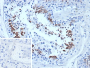 IHC staining of FFPE human testis tissue with CEN1 antibody (clone CETN1/9877). Inset: PBS used in p