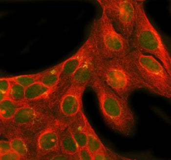 Immunofluorescent staining of FFPE human U-2 OS cells with NRG1 antibody (green) and Beta Tubulin mA