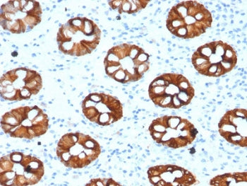 IHC testing of human colon with CK20 antibody (clone KRT20/1993). Required HIER: boil tissue section