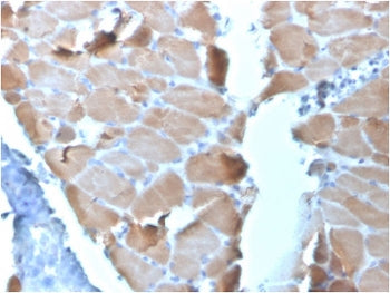 IHC staining of FFPE human cardiac muscle tissue with Actinin Alpha 2 antibody (clone ACTN2/3295). H
