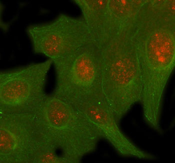 Immunofluorescent staining of SIRT6 using anti-SIRT6 antibody (red) and anti-Beta Tubulin antibody (