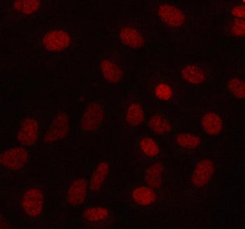 Immunofluorescent staining of MAMDC4 using anti-MAMDC4 antibody (red). MAMDC4 was detected in an imm