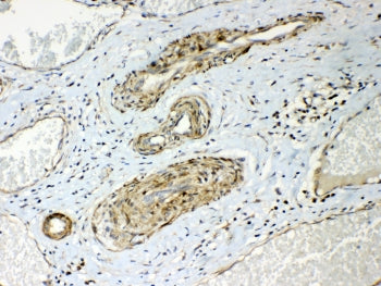 HSP22 Antibody