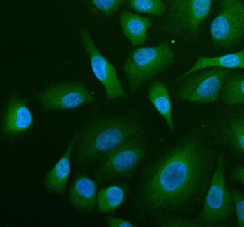 Immunofluorescent staining of ABR using anti-ABR antibody (green). ABR was detected in an immunocyto