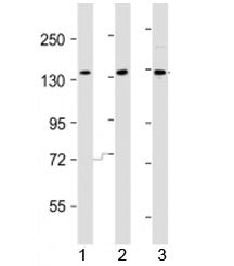 Western blot testing of AATK antibody at 1:2000 dilution. Lane 1: HeLa lysate; 2: HepG2 lysate; 3: A