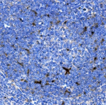 CXCL12 Antibody / SDF1