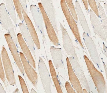 IHC testing of FFPE human skeletal muscle tissue with Myosin Light Chain 2 antibody. HIER: steam sec