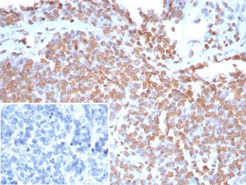 dsDNA Antibody / Double Stranded DNA