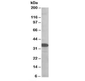 SMUG1 Antibody