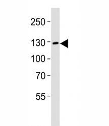 Western blot analysis of lysate from LNCaP cell line using JAK2 antibody diluted at 1:1000. Predicte