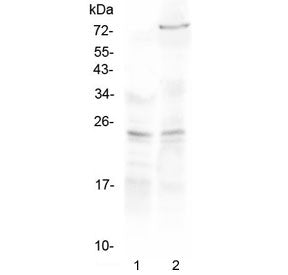 TIMP3 Antibody