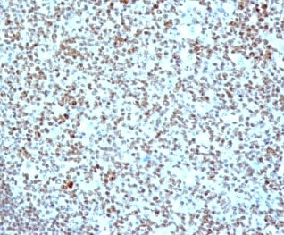 IHC: Formalin-fixed, paraffin-embedded human tonsil stained with anti-Nucleolin antibody (clone SPM6