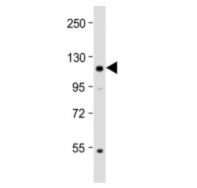 Western blot testing of Kloto antibody at 1:2000 + mouse brain lysate. Predicted molecular weight ~1