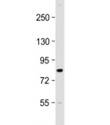 CIP2A Antibody / p90 Autoantigen / KIAA1524