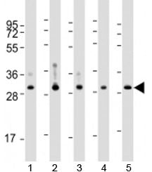 Western blot testing of human 1) MCF-7, 2) liver, 3) lung, 4) placenta and 5) kidney lysate with WBP