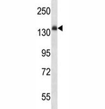 Anti-Insulin Receptor antibody western blot analysis in mouse liver tissue lysate. Expected molecula
