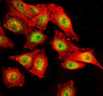 Immunofluorescent staining of SPOPL using anti-SPOPL antibody (green) and anti-Beta Tubulin antibody