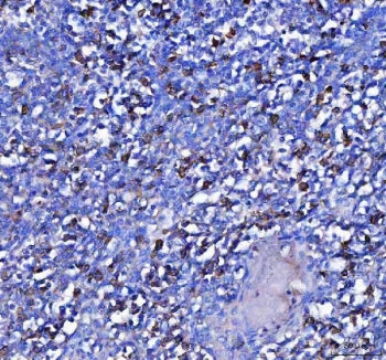IHC staining of FFPE human tonsil tissue with MZB1 antibody. HIER: boil tissue sections in pH8 EDTA