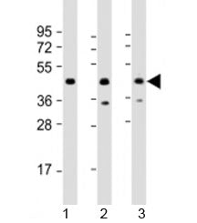 Western blot testing of human 1) 293T/17, 2) Jurkat and 3) K562 cell lysate with PHF6 antibody at 1: