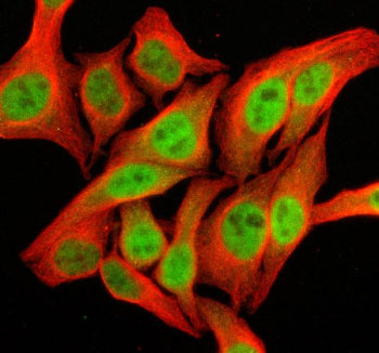 Immunofluorescent staining of SFMBT2 using anti-SFMBT2 antibody (green) and anti-Beta Tubulin antibo