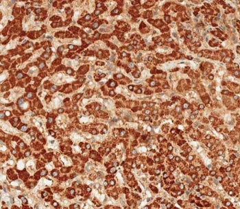 IHC testing of FFPE human liver tissue with ATG7 antibody. HIER: steam section in pH9 EDTA for 20 mi
