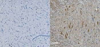 Neurofilament Antibody (-heavy) / Nf-h / Nefh