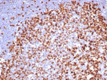 IHC staining of FFPE human tonsil. Ki67 antibody (clone MKI67/8315R). HIER: boil tissue sections in