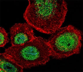 Fluorescent confocal image of A431 cell stained with LEF1 antibody at 1:25. LEF1 immunoreactivity is