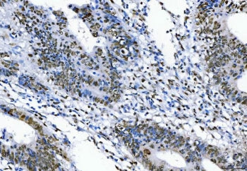 FUS Antibody / TLS