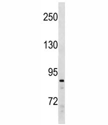 SUZ12 Antibody