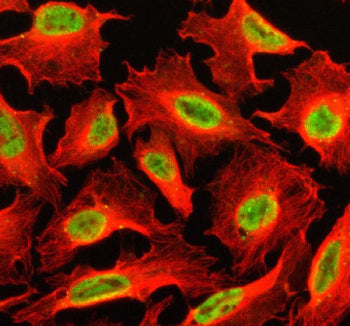 Immunofluorescent staining of SETBP1 using anti-SETBP1 antibody (green) and anti-Beta Tubulin antibo
