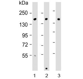 Western blot testing of 1) human Caco-2, 2) mouse kidney and 3) rat liver lysate with ATP7B antibody