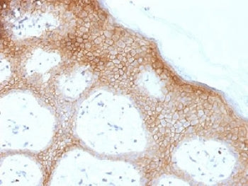 IHC testing of FFPE human skin with Desmoglein 1 antibody (clone DSG1/1733). Required HIER: boil tis