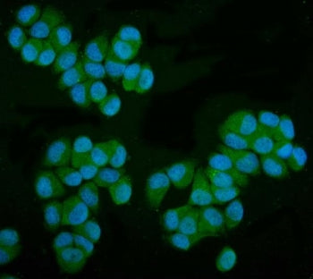 Immunofluorescent staining of FFPE human T-47D cells with Mannose Phosphate Isomerase antibody (gree