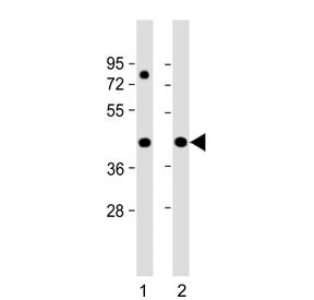 Western blot testing of human 1) HeLa and 2) Jurkat cell lysate with PRPF38A antibody. Predicted mol