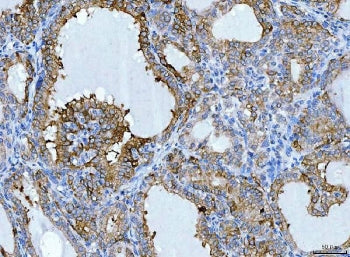 KRT7 Antibody / Cytokeratin 7