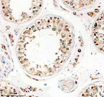 Immunohistochemical staining of TTLL1 using anti-TTLL1 antibody. TTLL1 was detected in a paraffin-em