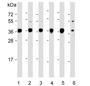 Western blot testing of human 1) U-87 MG, 2) U-2 OS, 3) SH-SY5Y, 4) 293T, 5) HepG2 and 6) mouse brai
