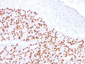 IHC testing of FFPE human thyroid with PAX8 antibody. Required HIER: boil tissue sections in 10mM Tr