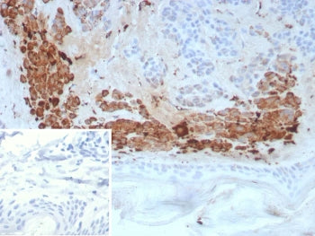 Kallikrein 4 Antibody / KLK4