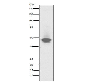 Western blot testing of human spleen lysate with CD79a antibody. Expected molecular weight: 25-47 kD