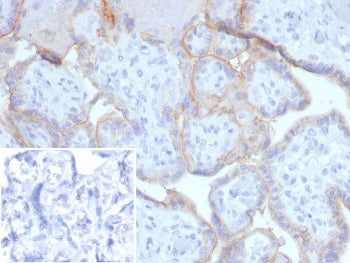 IHC staining of FFPE human placental tissue with EGF Receptor antibody (clone EGFR/4616). Inset: PBS