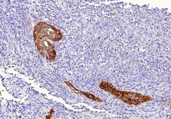 IHC staining of FFPE human lung tissue with Tissue Factor antibody (clone CD142/9196). HIER: boil ti